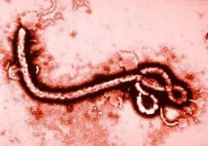 ebola-disease1